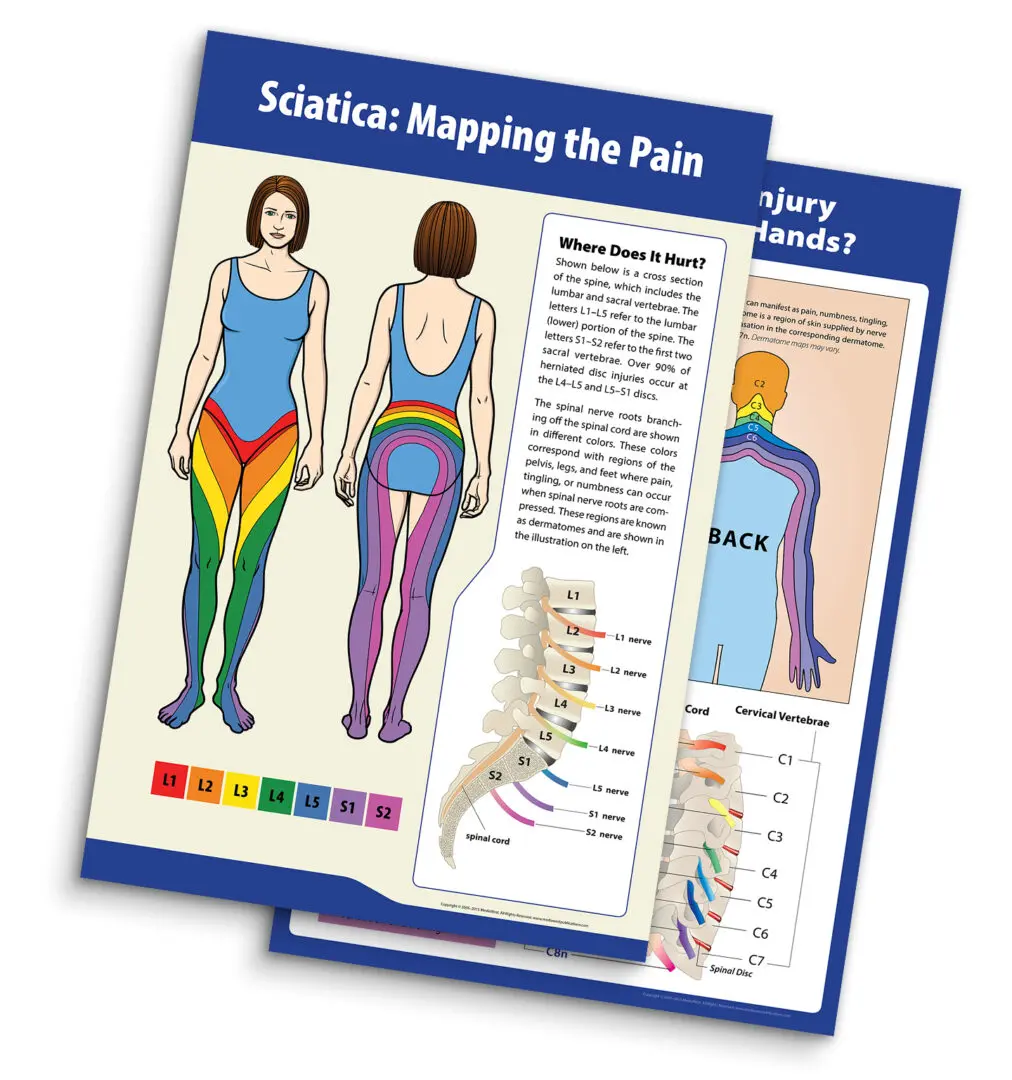 Two pages of a book with the words " sciatica : mapping the pain ".